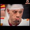 Patrick Mahomes Sad Face Meme Super Bowl LIX PNG Download